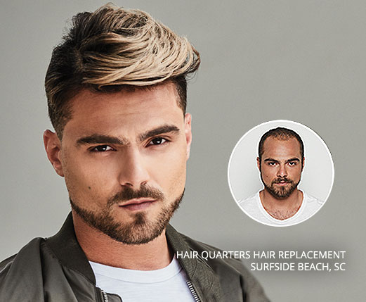 hair replacement men myrtle beach sc