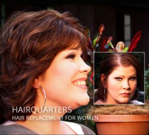 thinning hair solutions south carolina