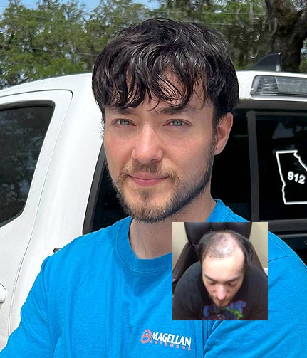 Transitions Men's Hair Replacement Myrtle Beach SC